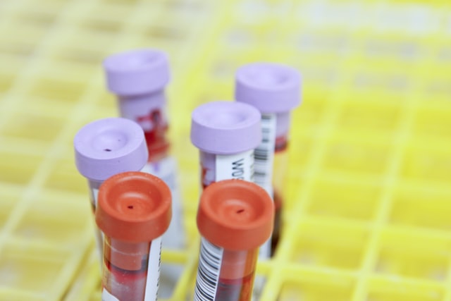 test tubes of blood with purple and red stoppers in a yellow grid