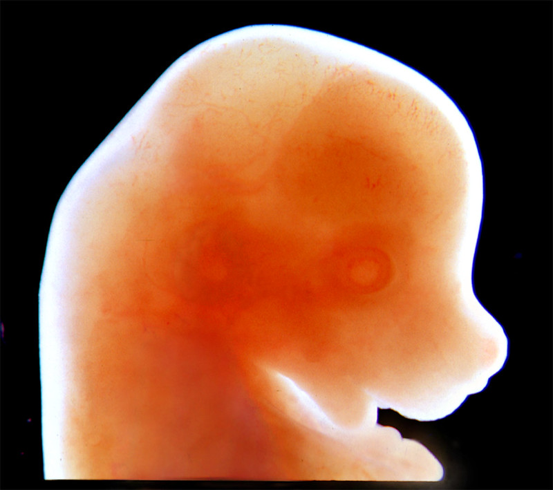 head of a mouse embryo