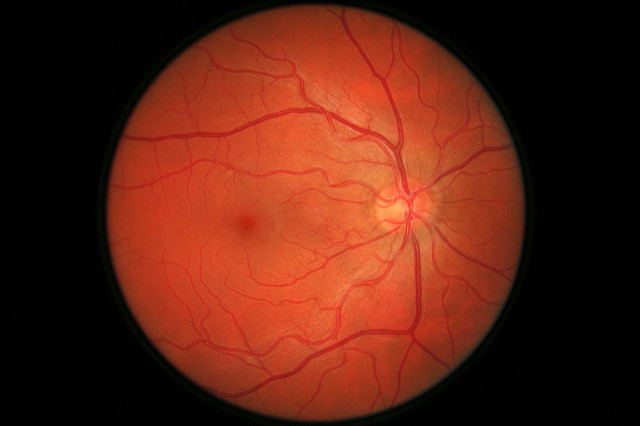 Retina scan of an eye.