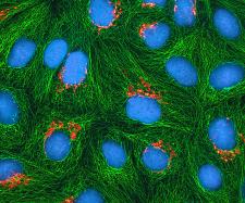 Cultured HeLa cells [Wikimedia]