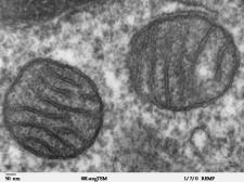 Mitochondria mammalian lung