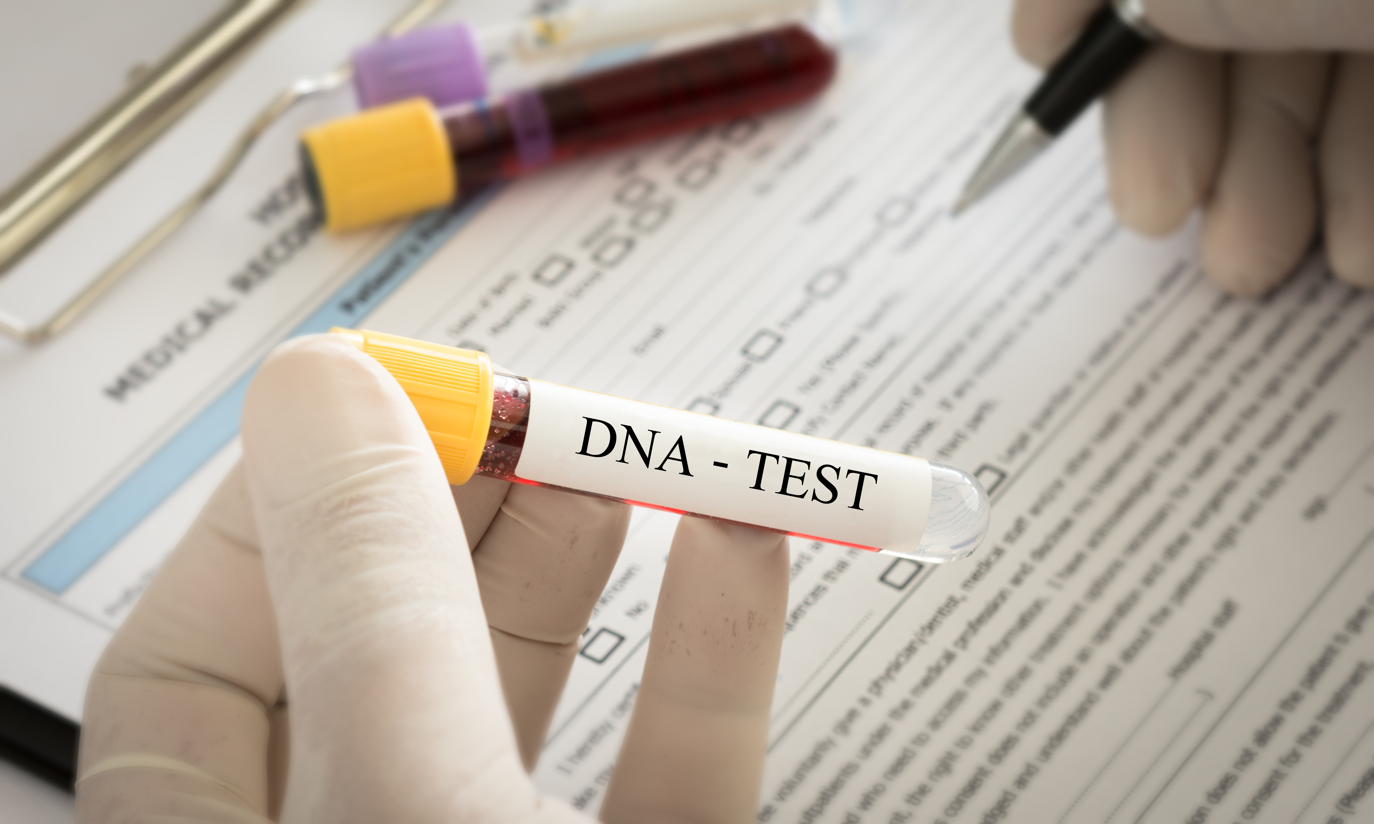 a test tube with "DNA TEST" written on it, held by a gloved hand