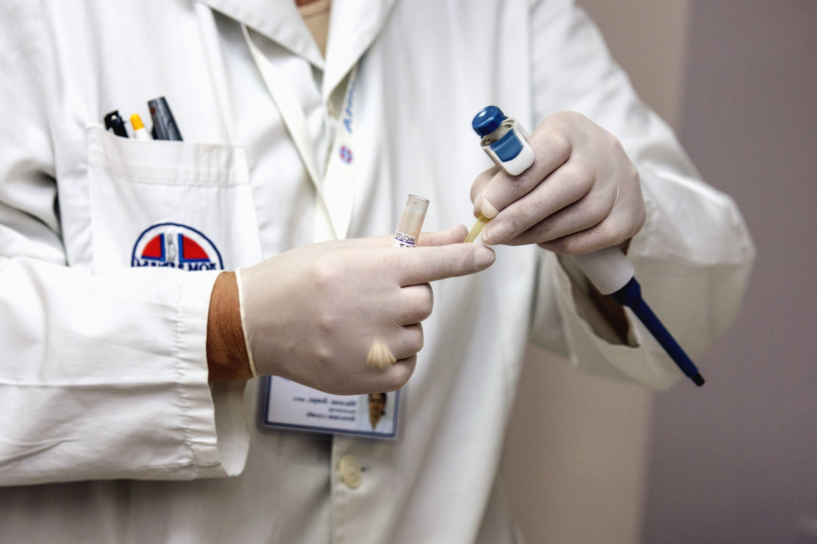 Doctor holding pipette