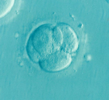 dividing fertilized cell