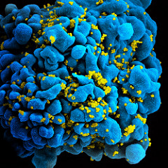 Scanning electromicrograph of an HIV-infected T cell