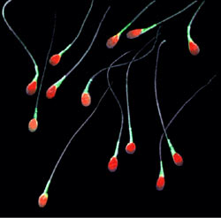 colorized sperm on a black background