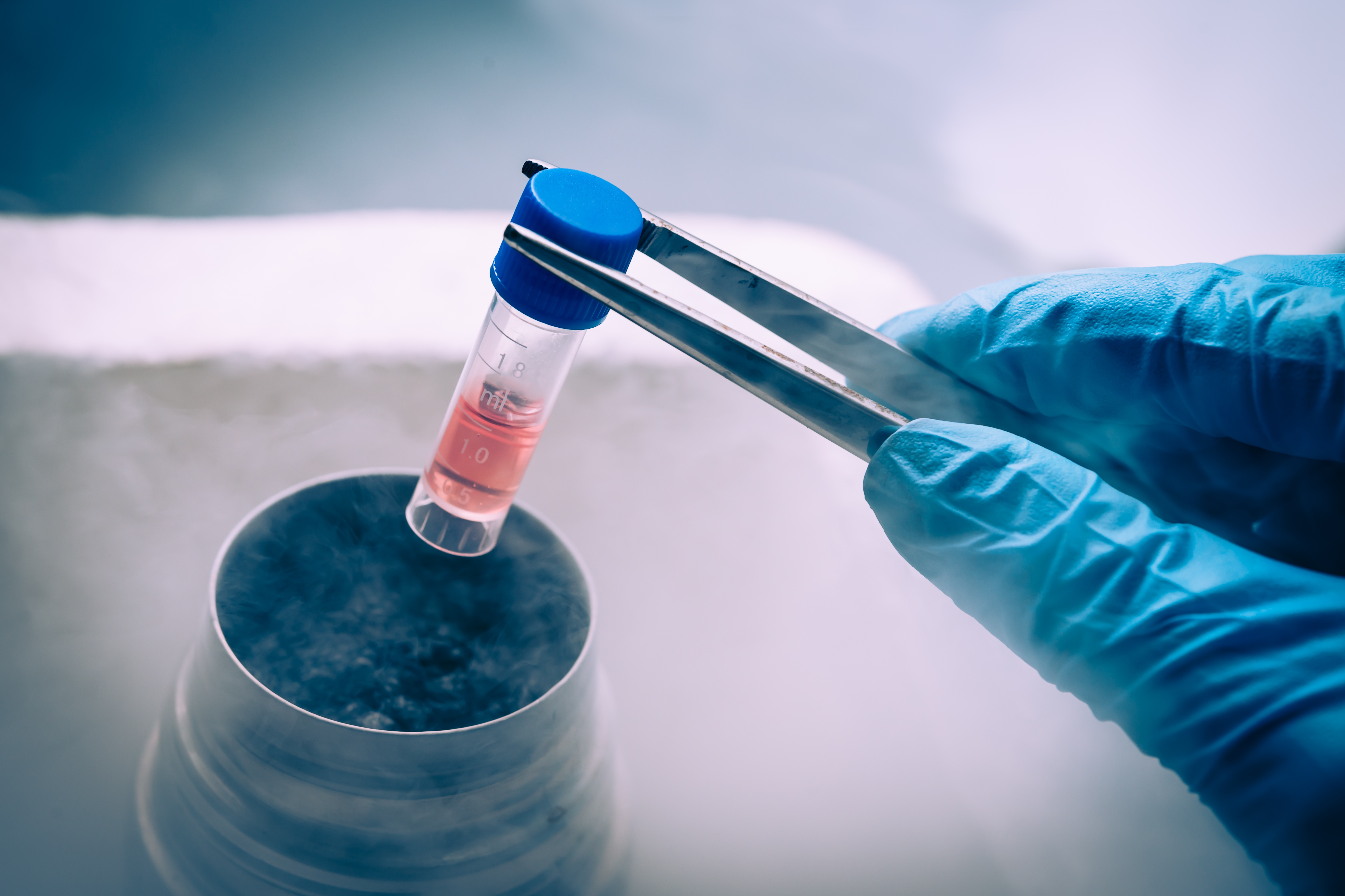 gloved hand holding a vial of stem cells with tweezers