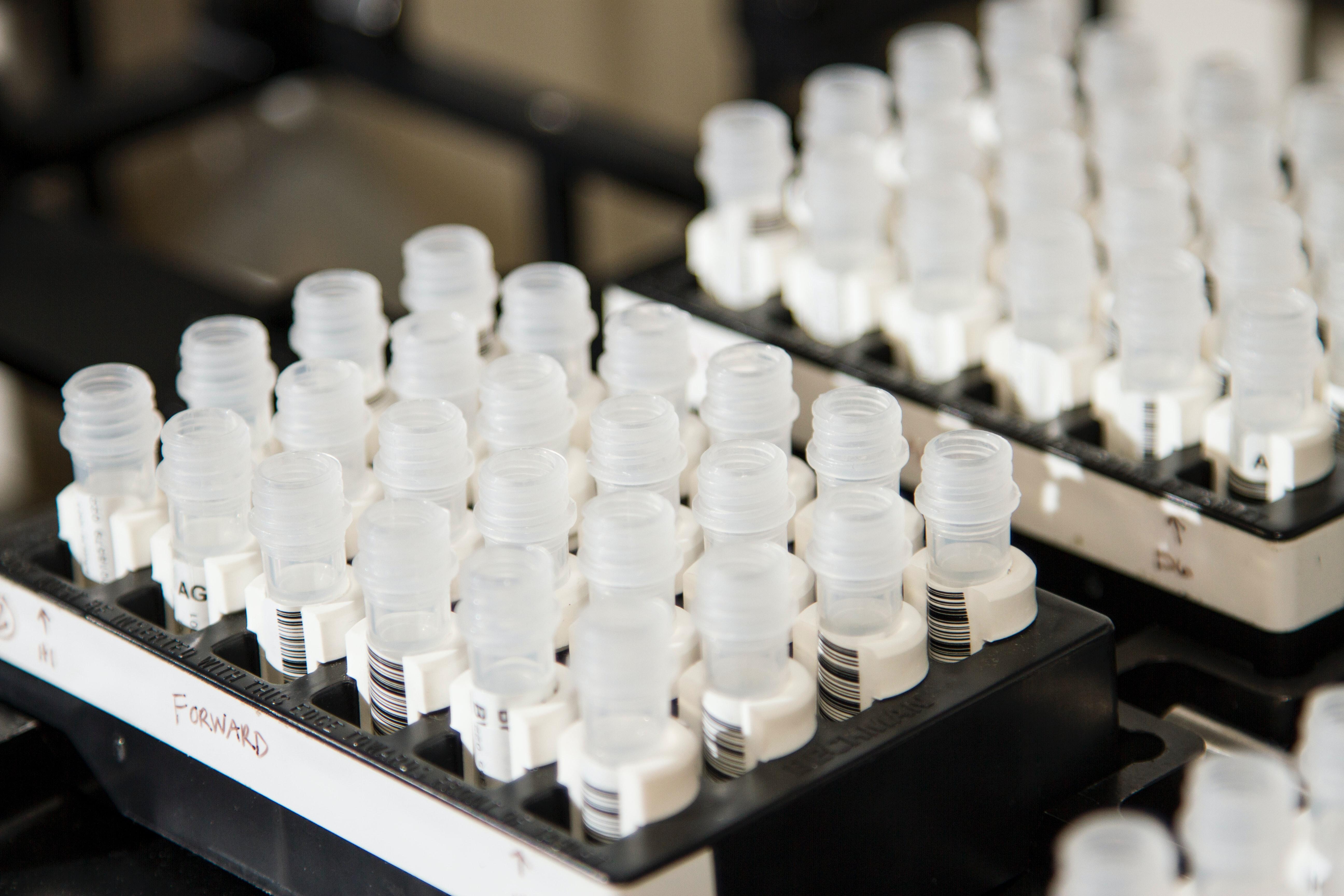 test tubes in a canister tray