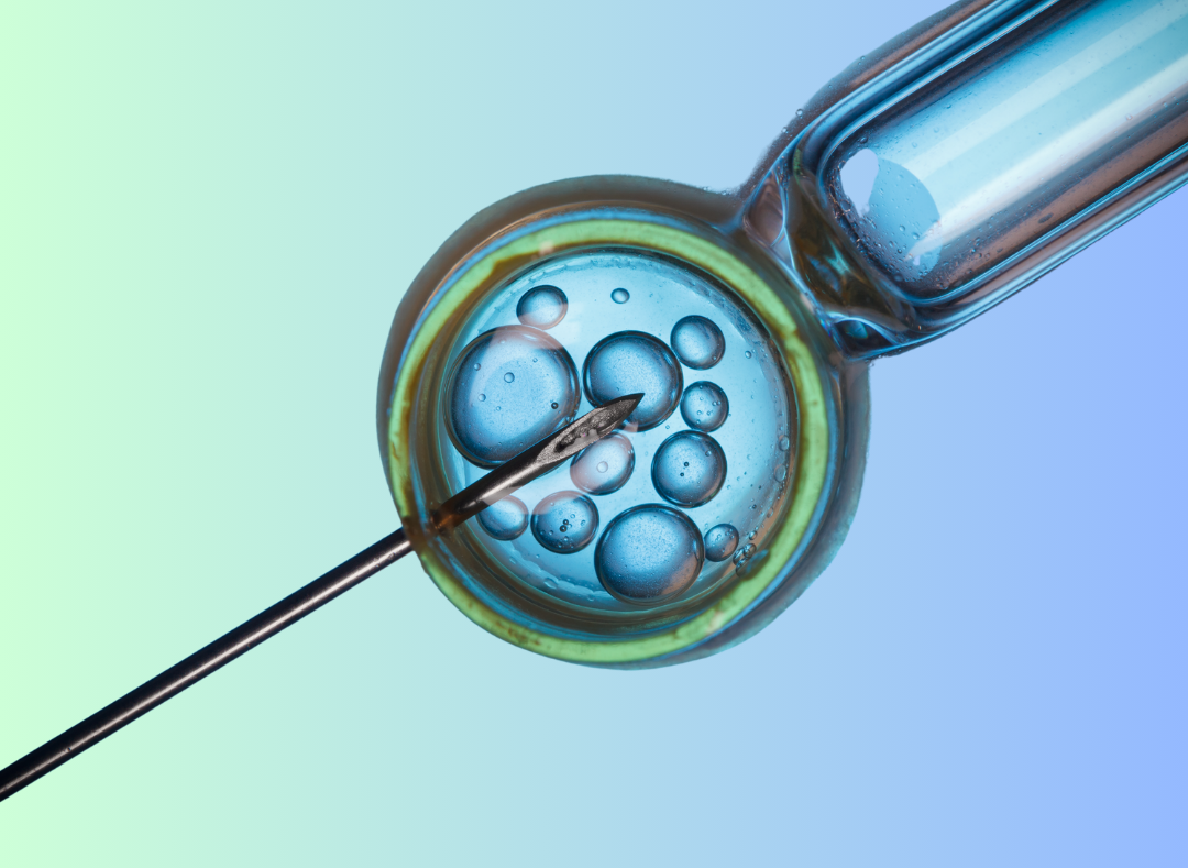 image of IVF 