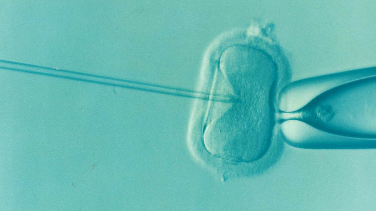 Image of in vitro fertilization