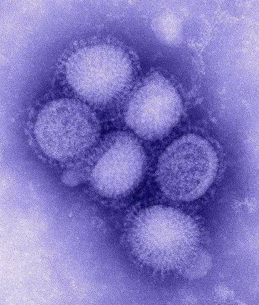 Microscope image of H1N1 virus