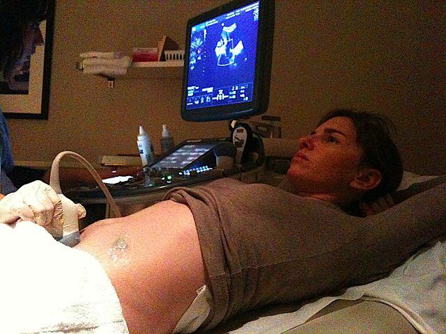 A woman is laying on a doctor's bed, undergoing an ultra-sound examination. 