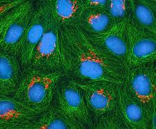 Cultured HeLa cells [Wikimedia]