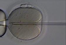 Microscopic image of an egg injected with sperm via in vitro fertilization method.