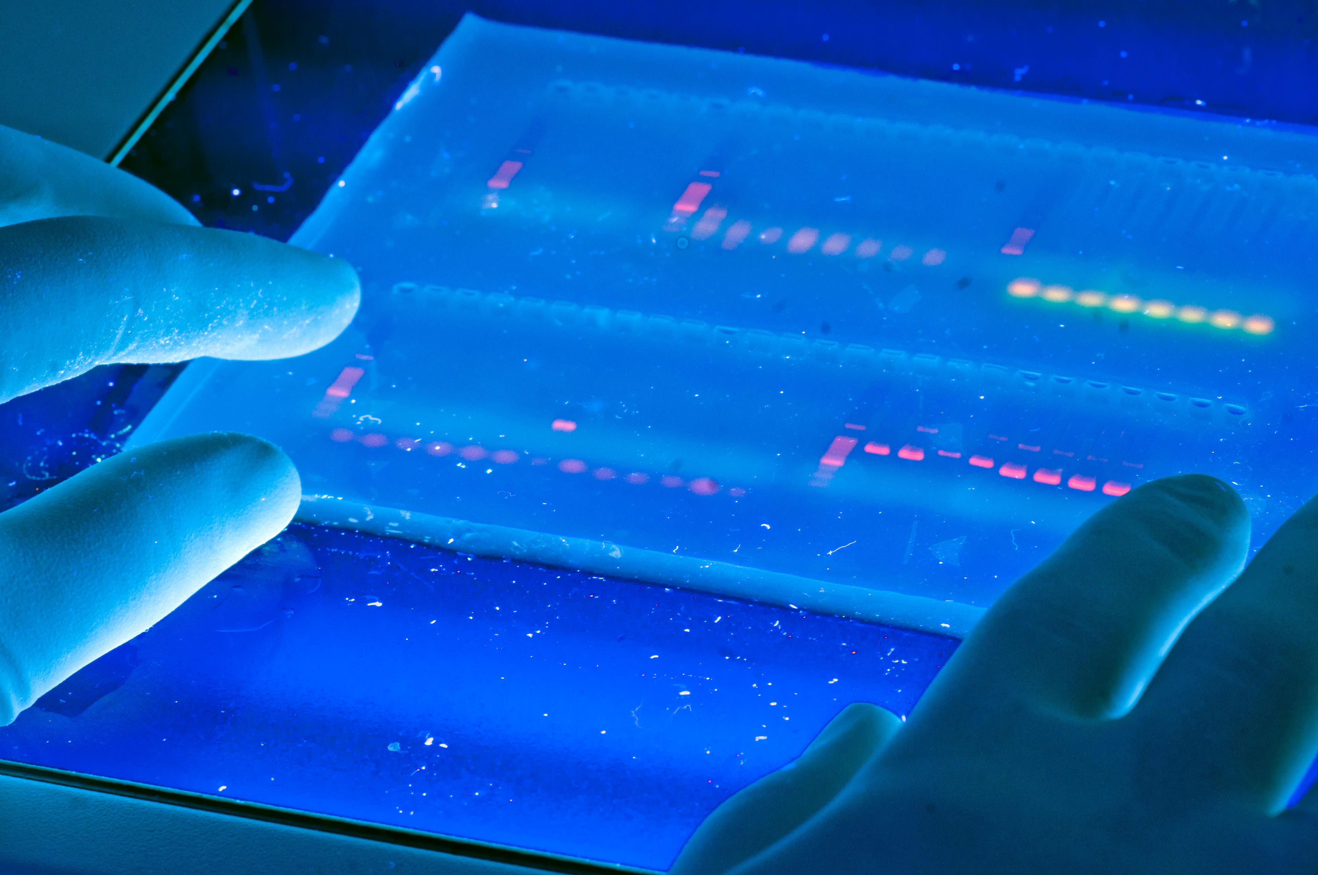 Gel DNA plate with UV illumination