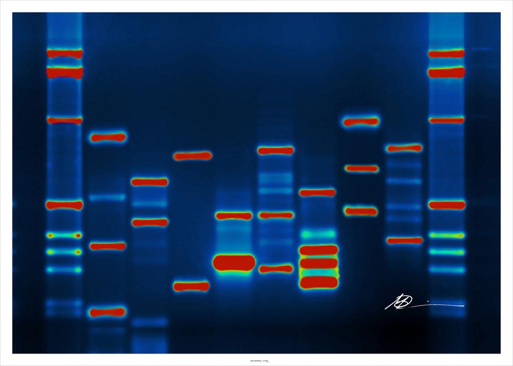 Colorful bands indicating DNA test results against a dark blue background