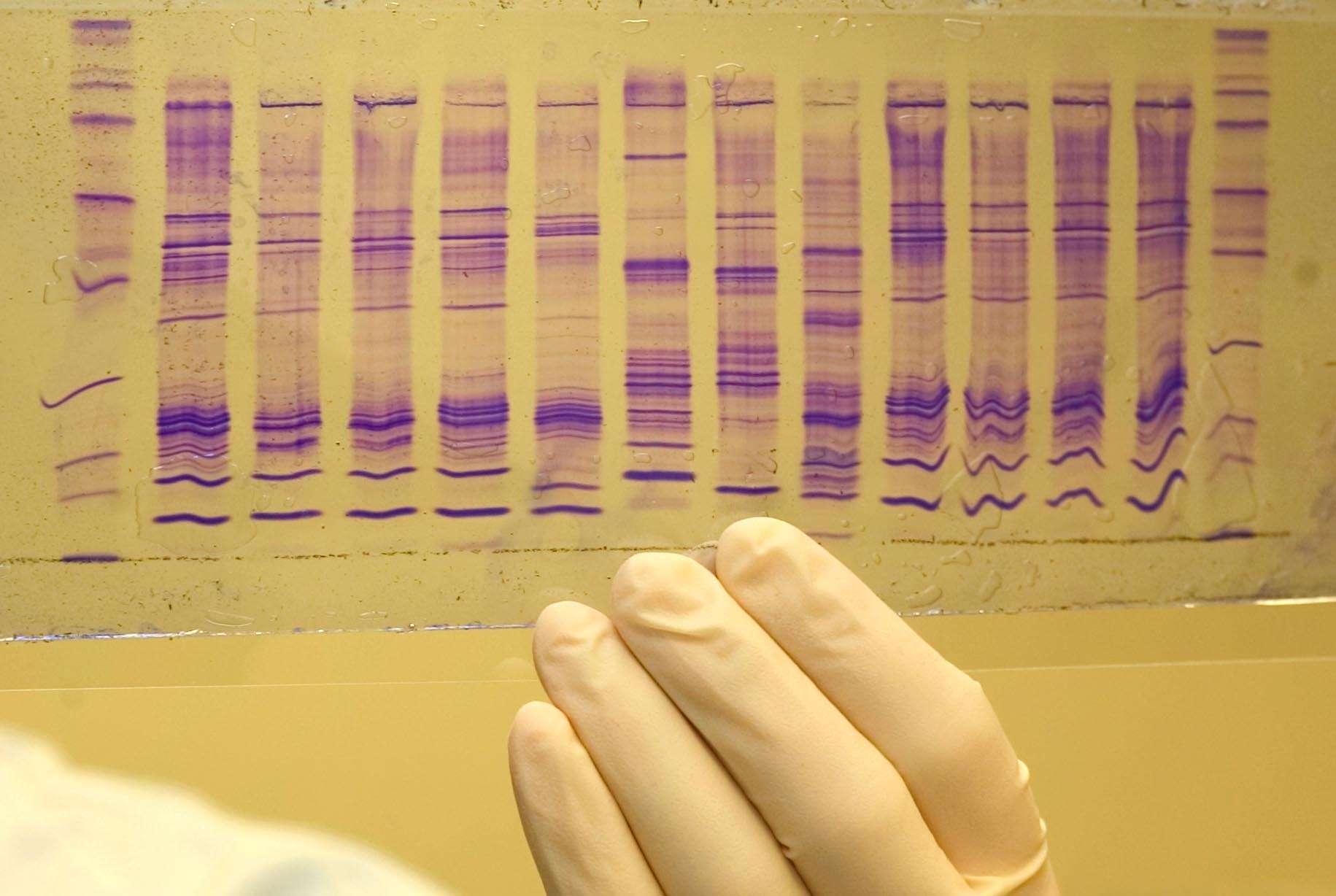 gloved hand holding a forensic DNA result