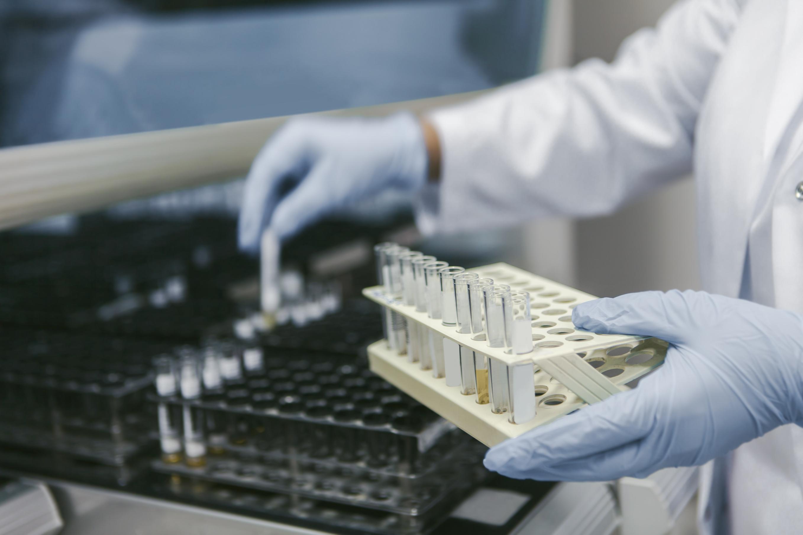 Gloved hands moving small test tubes from one test tube rack to another 