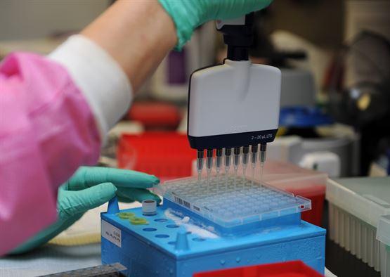 A laboratory scientist's right arm is shown, using a multi-channel pipette.